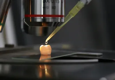 Snapshot of the repairing experiment on a human tooth